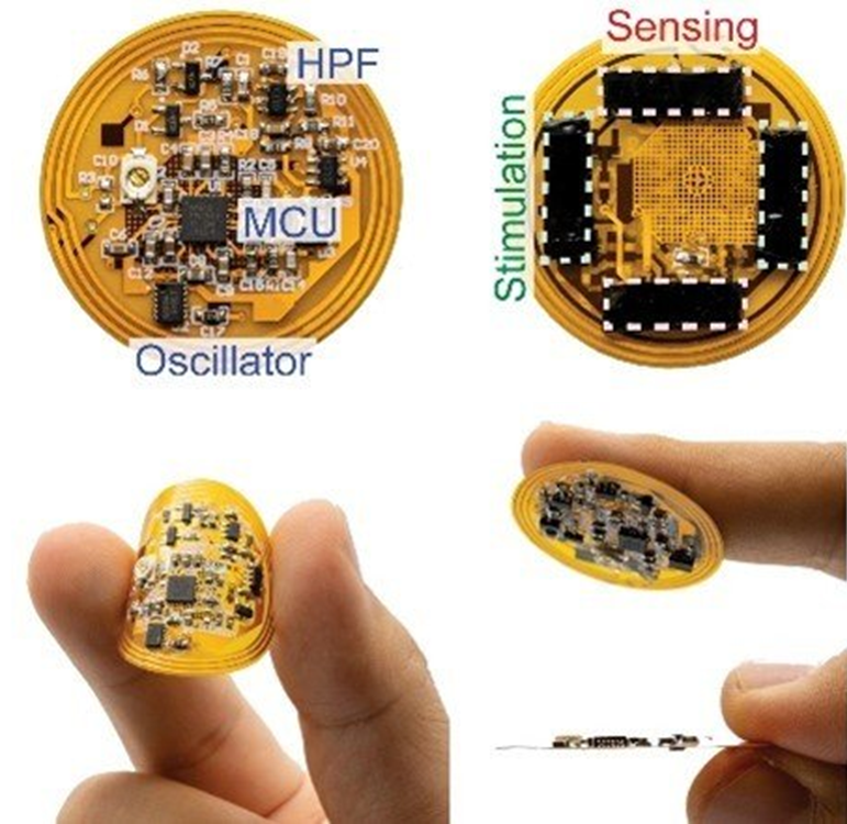 Smart bandage components and features