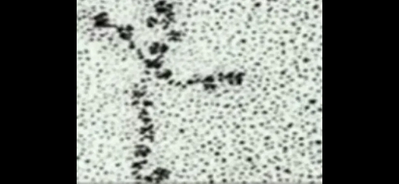 Electron microscope image showing Laminin structure