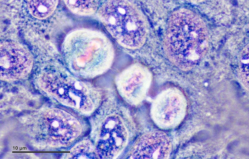 Henrietta Lacks and her contribution to medical research.